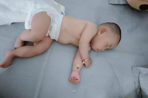 广汉宝宝脸上有白色斑块